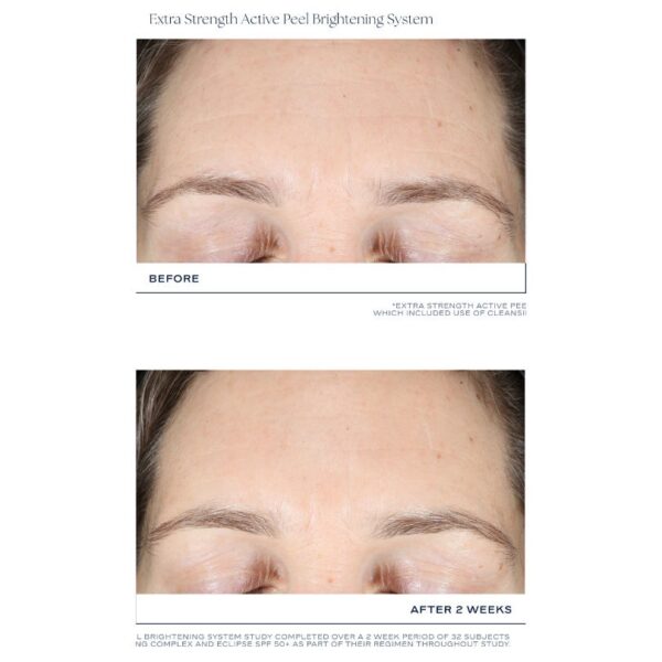 iS Clinical - EXTRA STRENGTH ACTIVE PEEL BRIGHTENING SYSTEM - Image 5